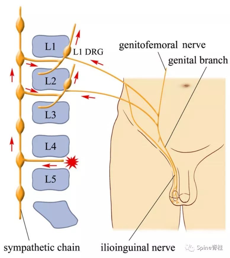 脊柱的神经支配,脊柱神经引起手臂疼痛