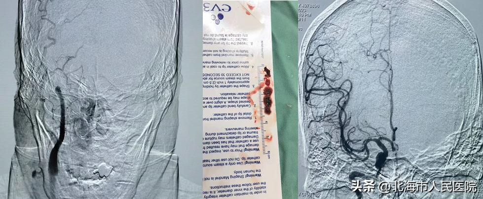 广西神经外科专科排名,广西神经内科最好的专家