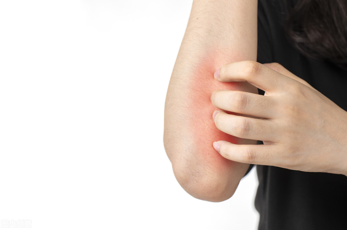 老年皮肤瘙痒吃什么水果能缓解,老年皮肤干燥瘙痒可以擦凡士林吗