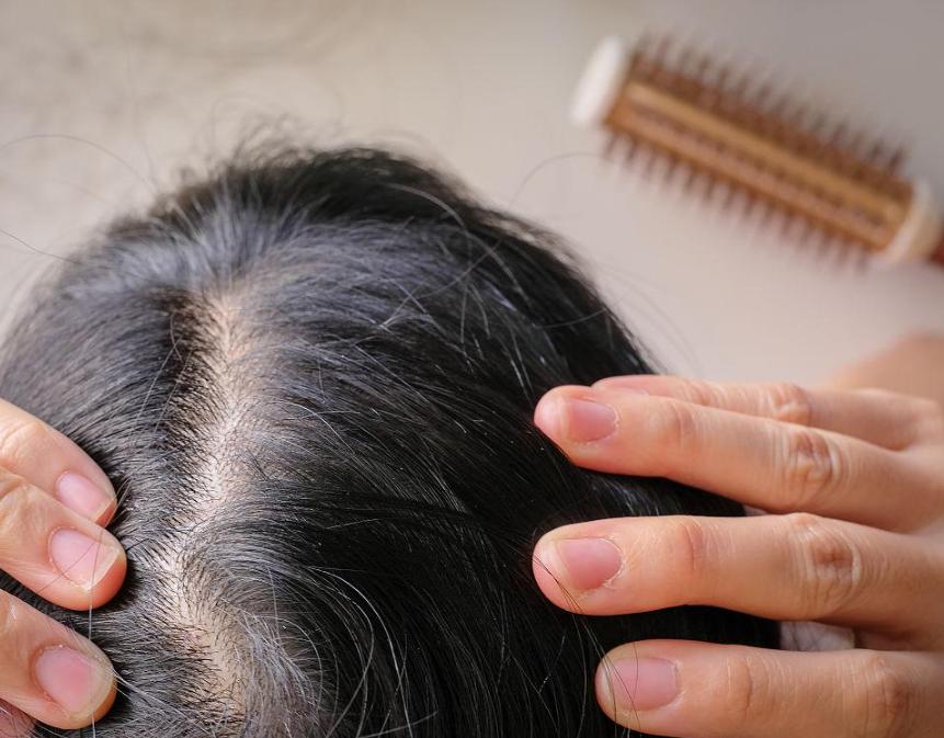 身体缺少黑色素导致白发吃什么好,身体缺什么造成白发