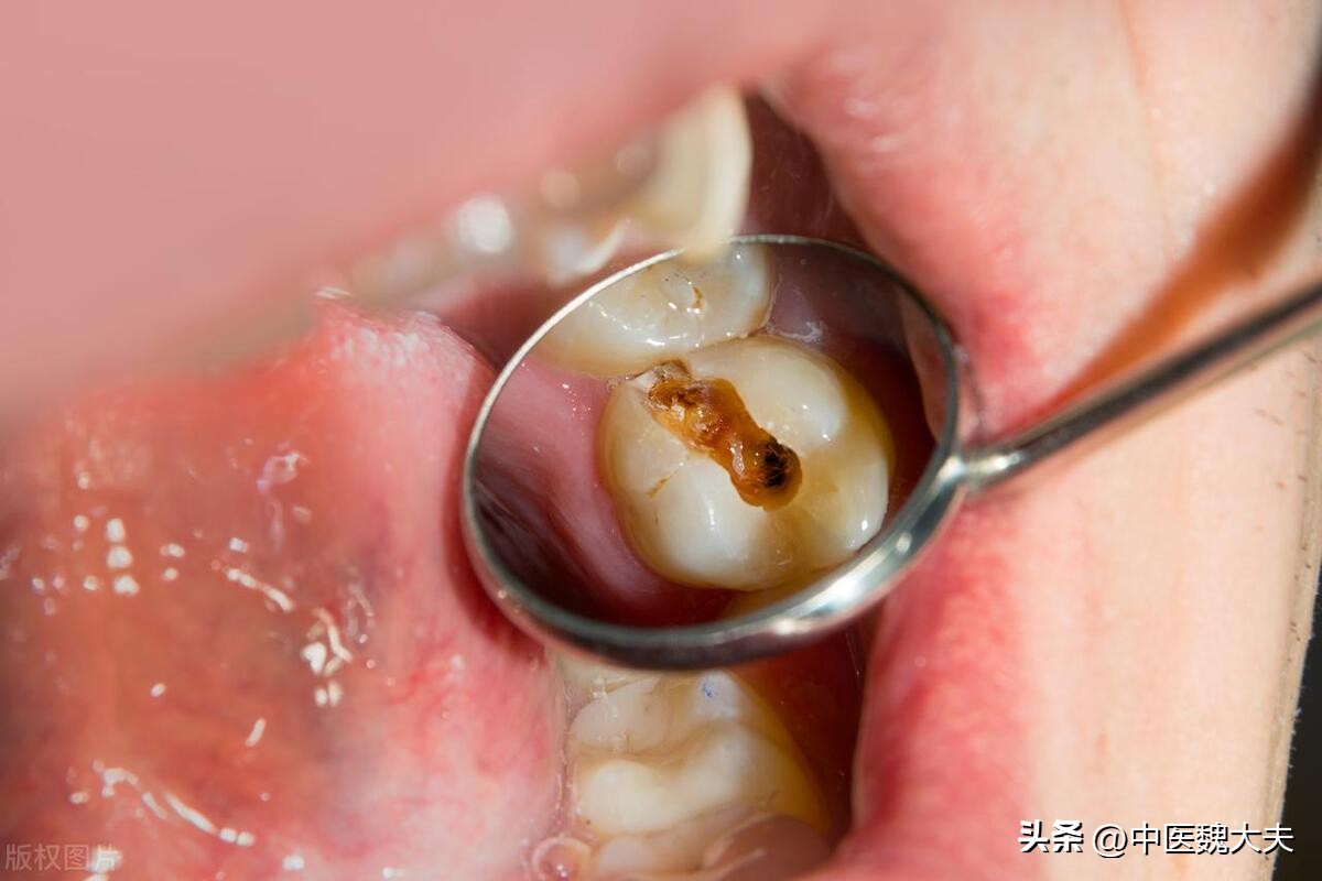 睡觉流口水是什么病的前兆,睡觉流口水要警惕四种疾病