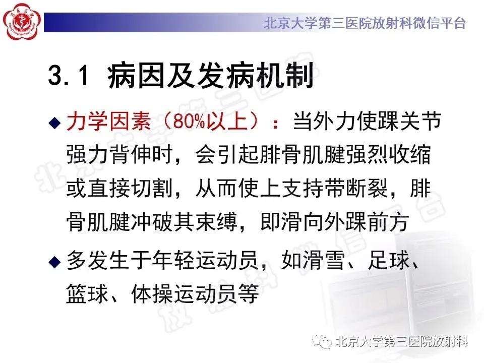 好文分享续集,腓骨肌腱脱位手术价格