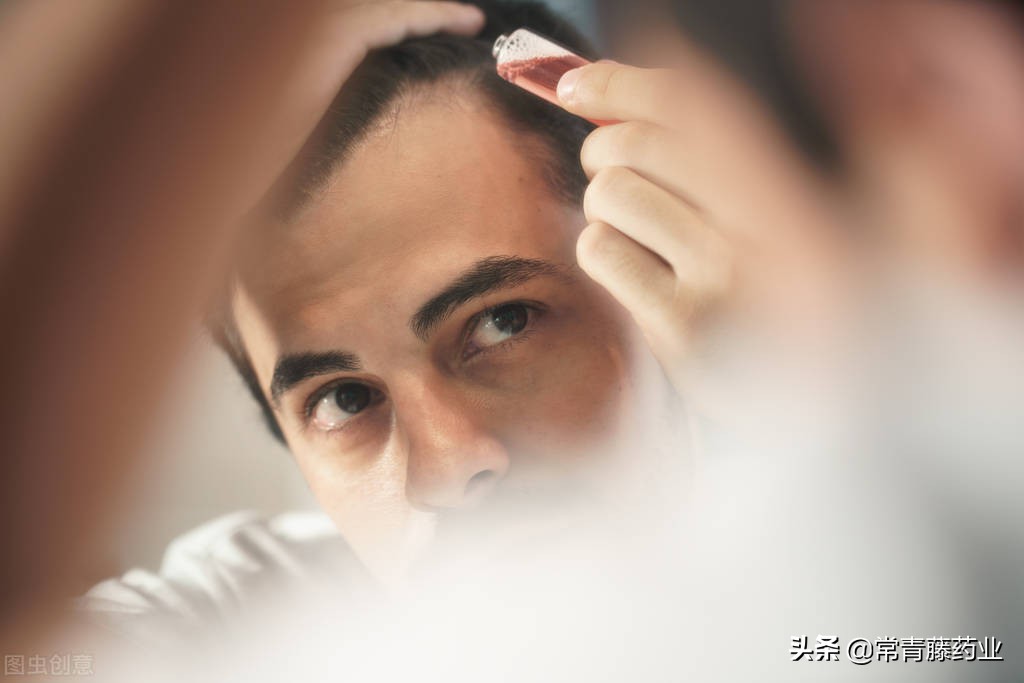 治脱发只用米诺地尔酊有效果吗,有没有用米诺地尔治好脱发的