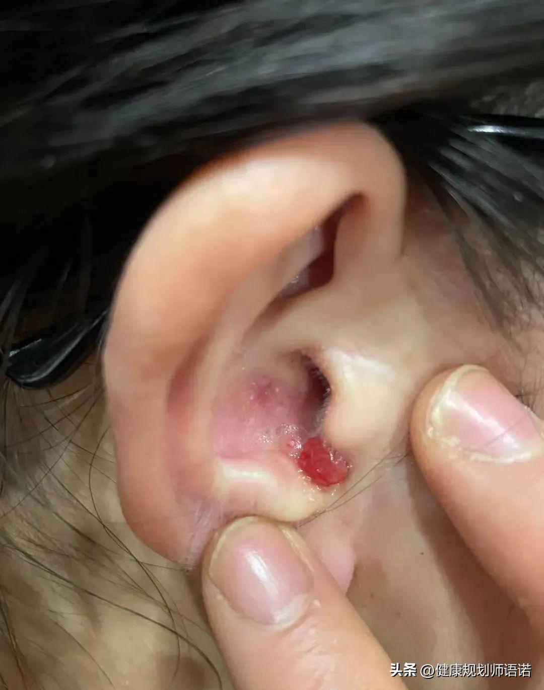 因宫颈问题走进阳光森林，用营养拯救了整个家族的健康