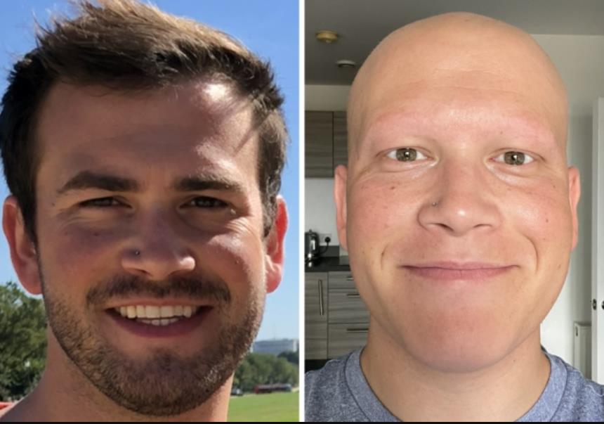 美国一位男子得了罕见的病,美国男子患罕见病症