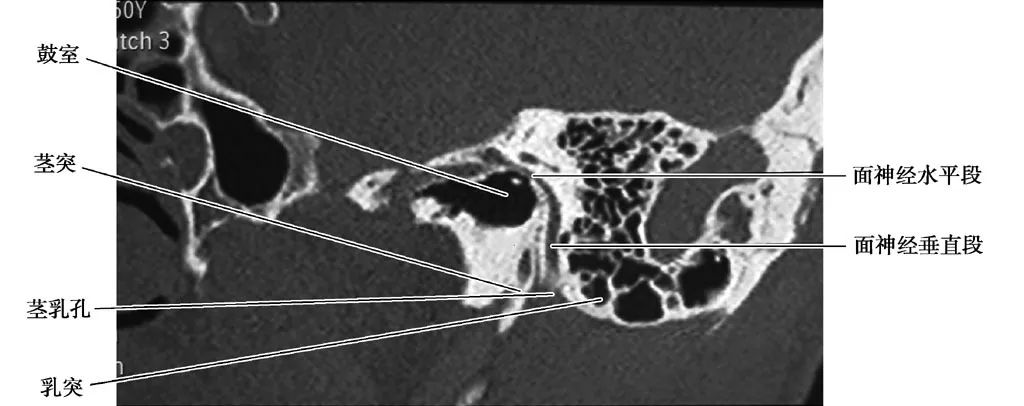 耳部解剖结构和生理功能,耳部解剖笔记