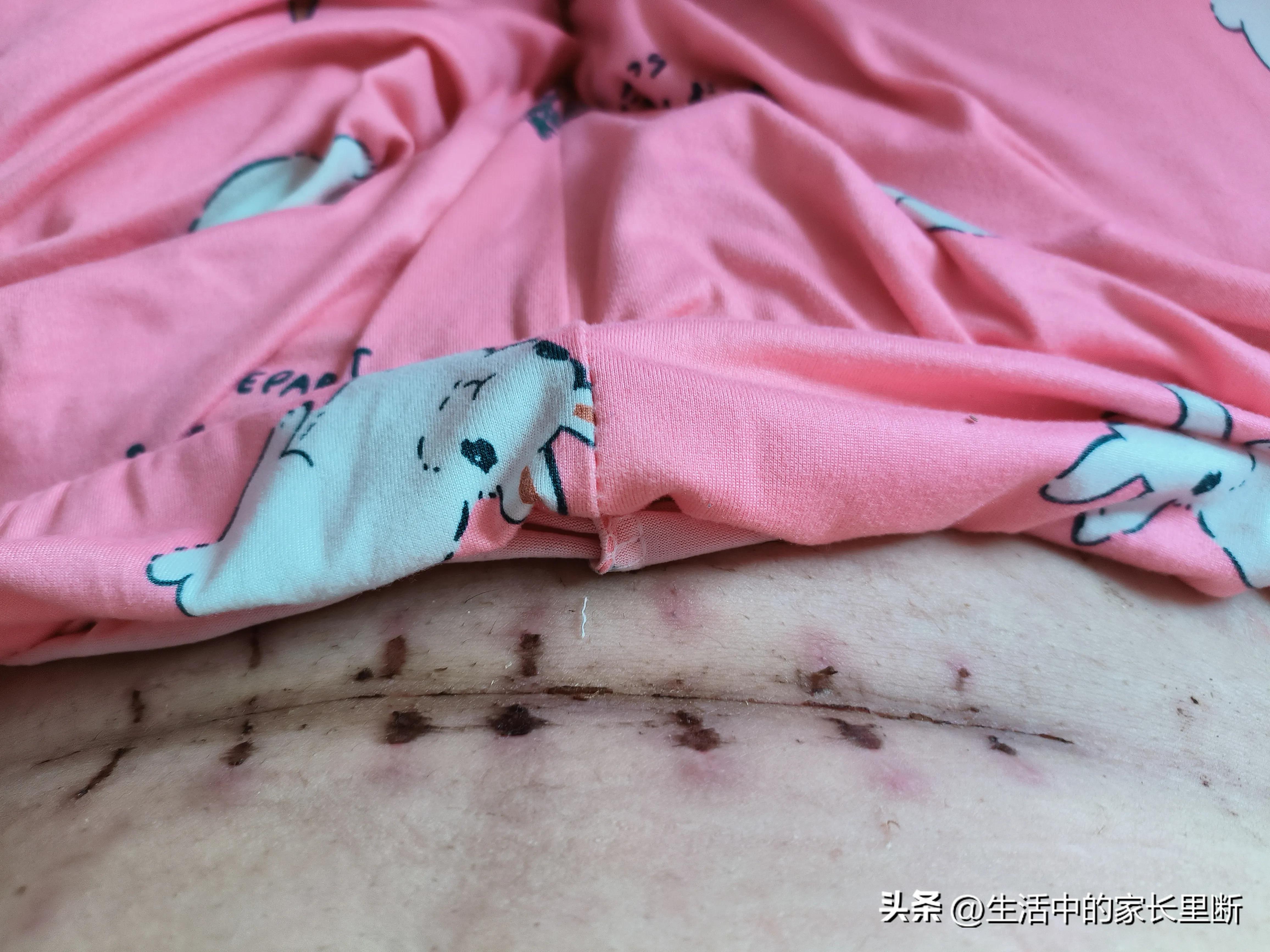 剖腹产和顺产哪个疼孕妈回答,剖腹产和顺产我该怎么选啊