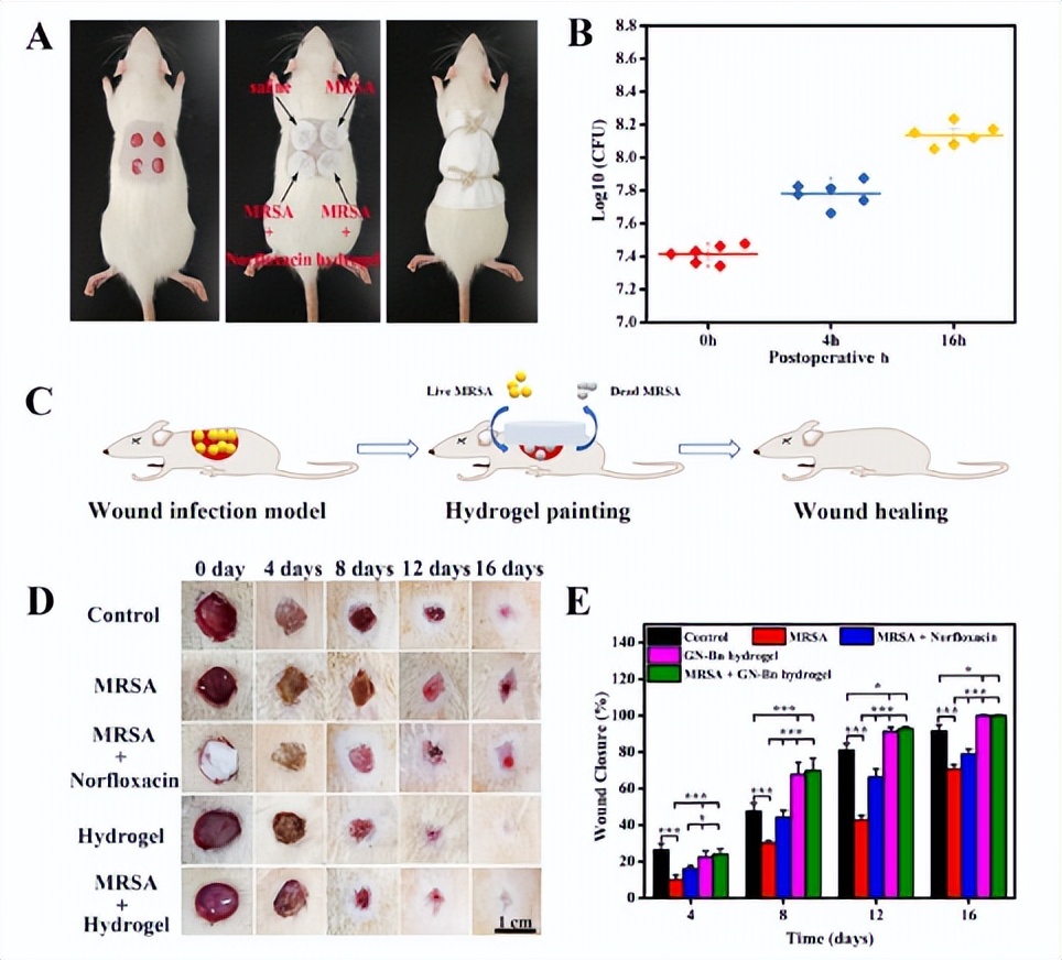 金黄色葡萄球菌甲硝唑凝胶,医用抗菌凝胶对尿道炎有用吗