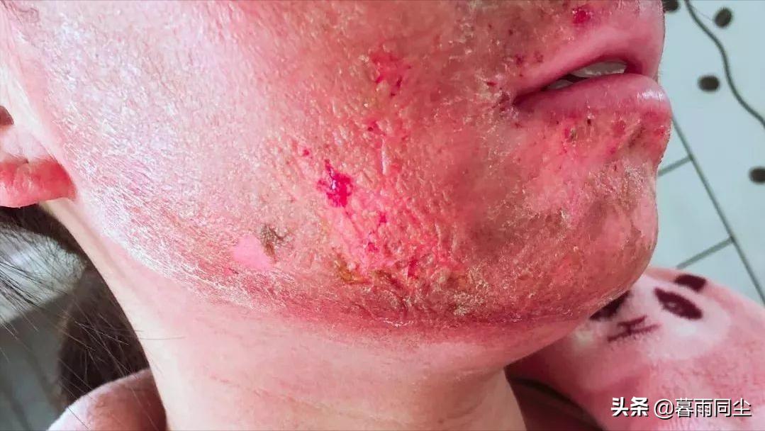 当你遇到核打击该怎么办,当你遭到攻击怎么反击