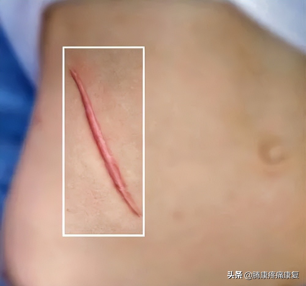 ha玻尿酸极润保湿,ha玻尿酸护肤品好吗