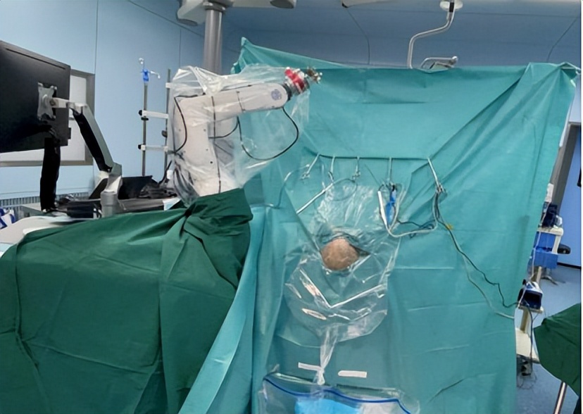 江西治疗帕金森,江西帕金森手术