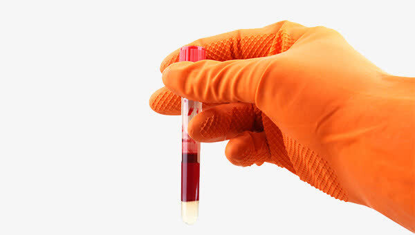 天坛生物专注血液制品,天坛生物净利润低是什么原因