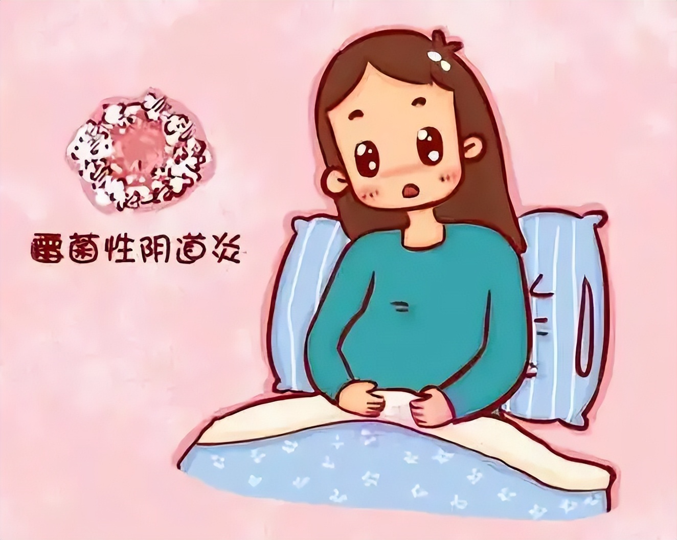 教你怎么辨别滴虫性、霉菌性、细菌性、萎缩性阴道炎