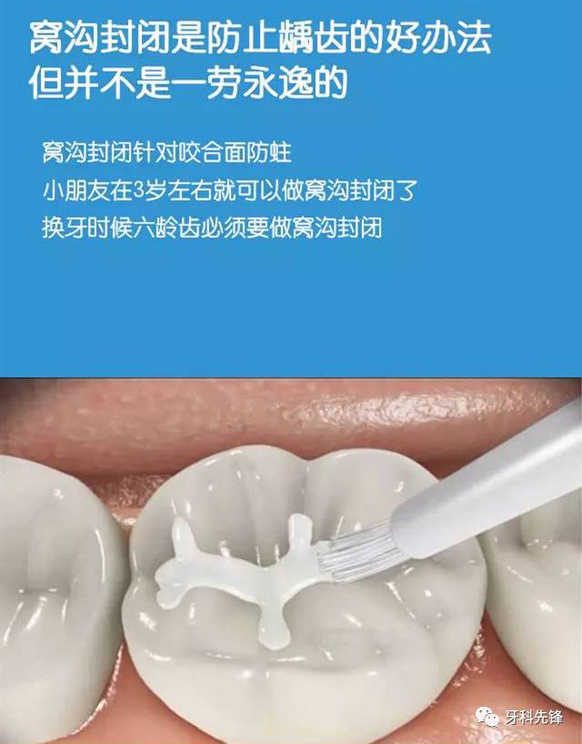 家长必知的儿童口腔知识,健康宣教口腔知识