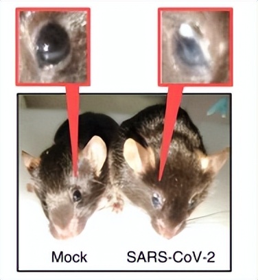 结膜炎一直流眼泪视线模糊,结膜炎好了总是流眼泪怎么回事