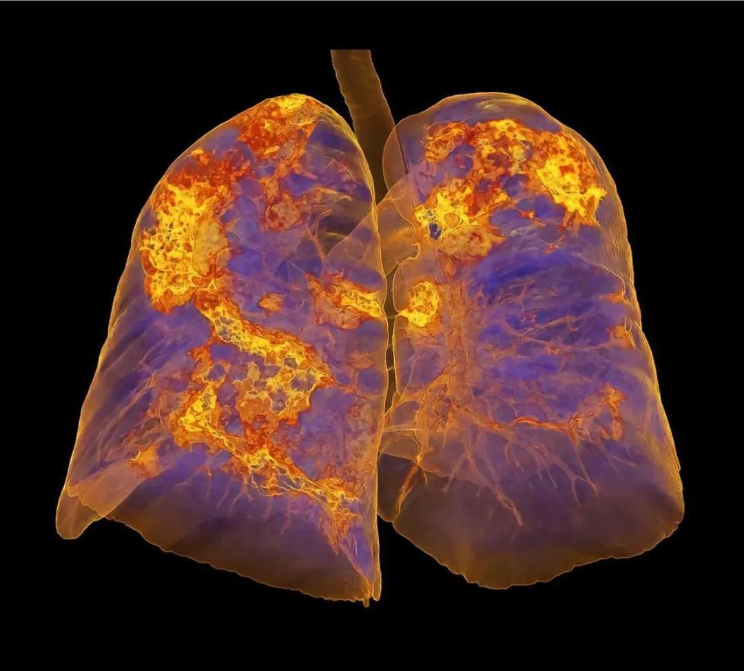 新冠康复指南心得体会,新冠康复指南手册最新版