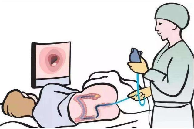 男医生给女性做“肠镜”检查，会觉得尴尬吗？不妨进来了解