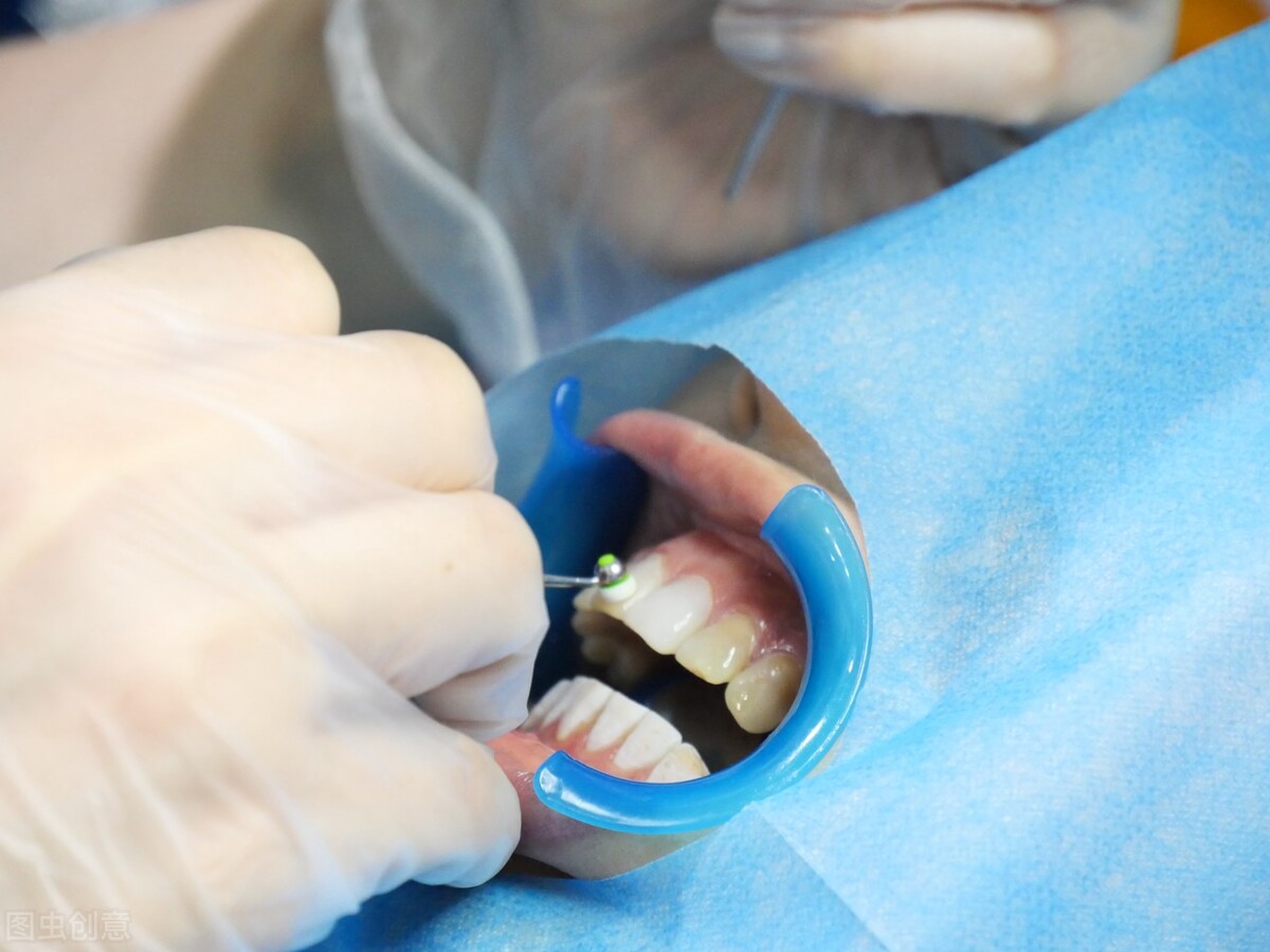 抽烟喝咖啡牙齿变黄还可以变白吗,长期喝咖啡牙齿会发黄吗