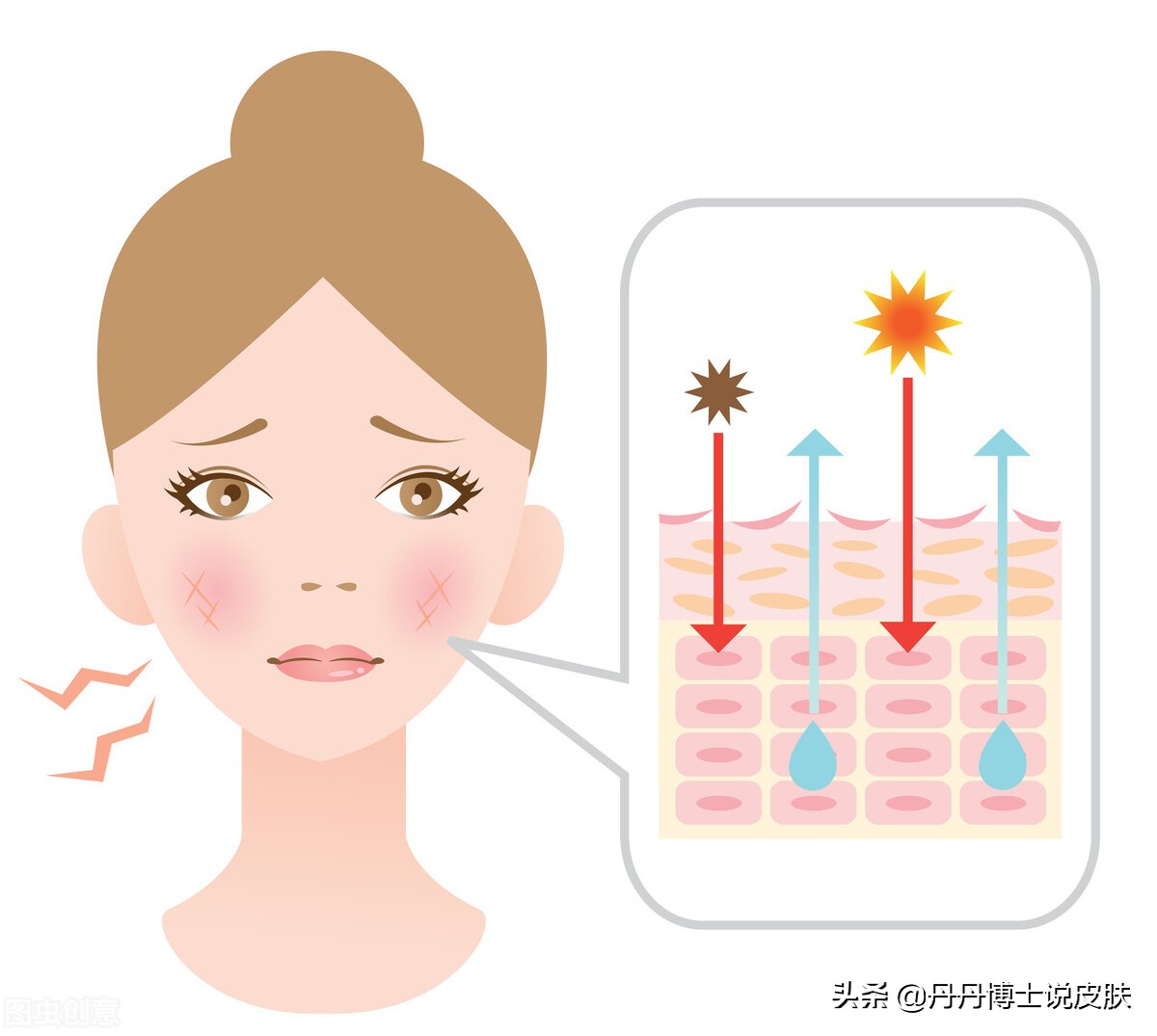 皮肤干燥、敏感、泛红、刺痛？可能是皮肤屏障出了问题