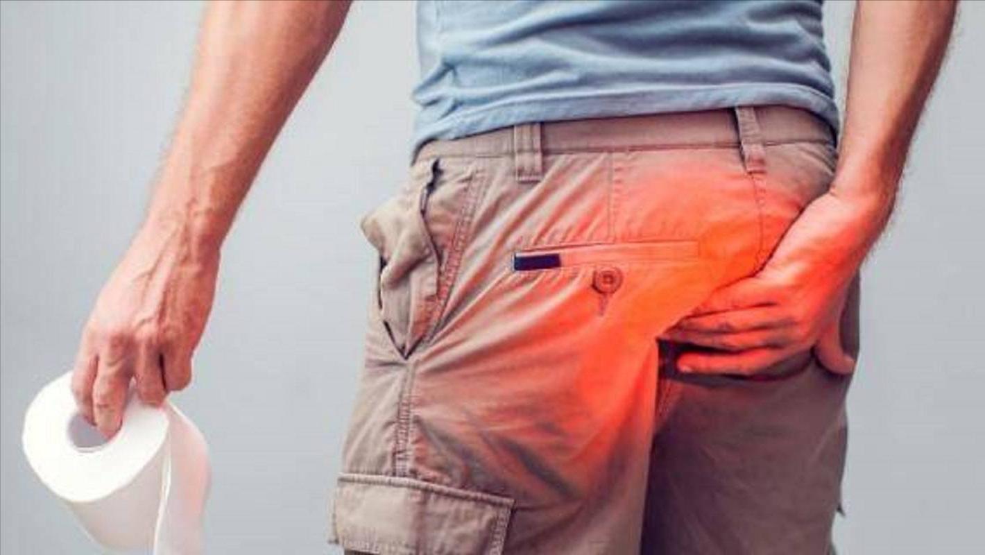 治疗痔疮手术后潮湿瘙痒用的药膏,混合痔术后止痒药膏