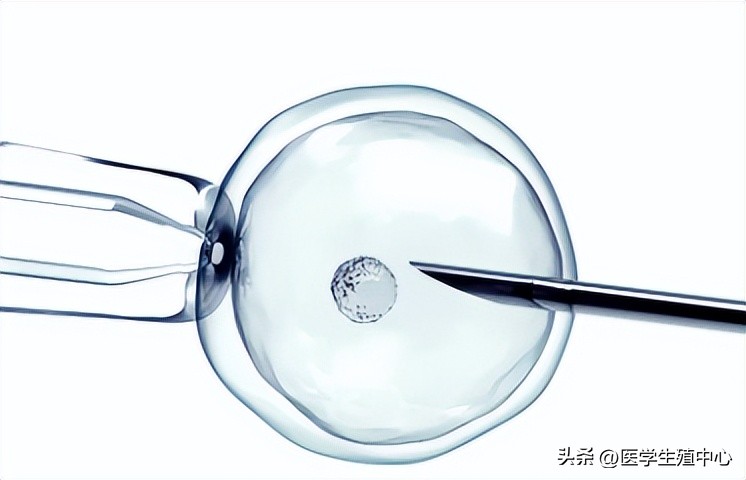 有卵泡不发育怎么回事,有卵泡不排卵怎么回事