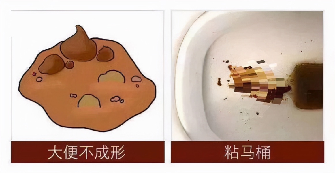 裂纹舌中间裂纹凹陷是大病么,先天性裂纹和后天性裂纹舌的区别