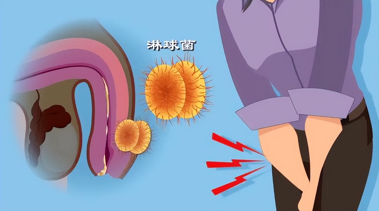 8大性传播疾病,8种心理疾病