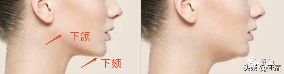 牙齿正畸和骨骼正畸的区别,牙齿正畸和眼轴增长有关系吗