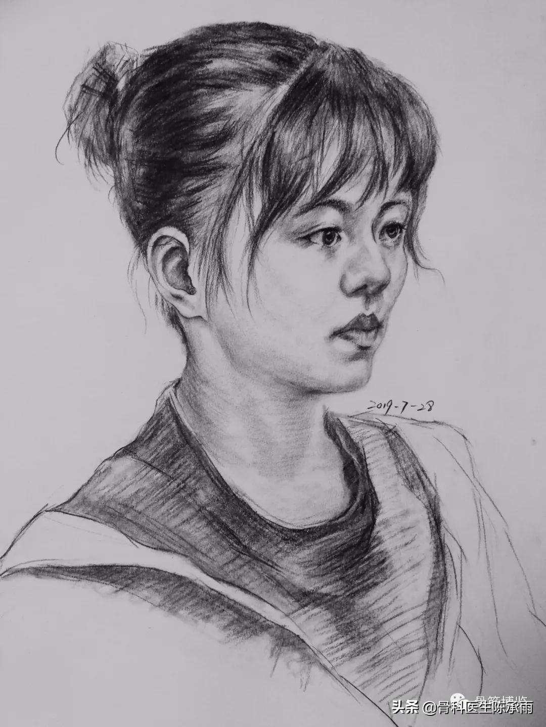 肩袖损伤诊断及关节镜下治疗