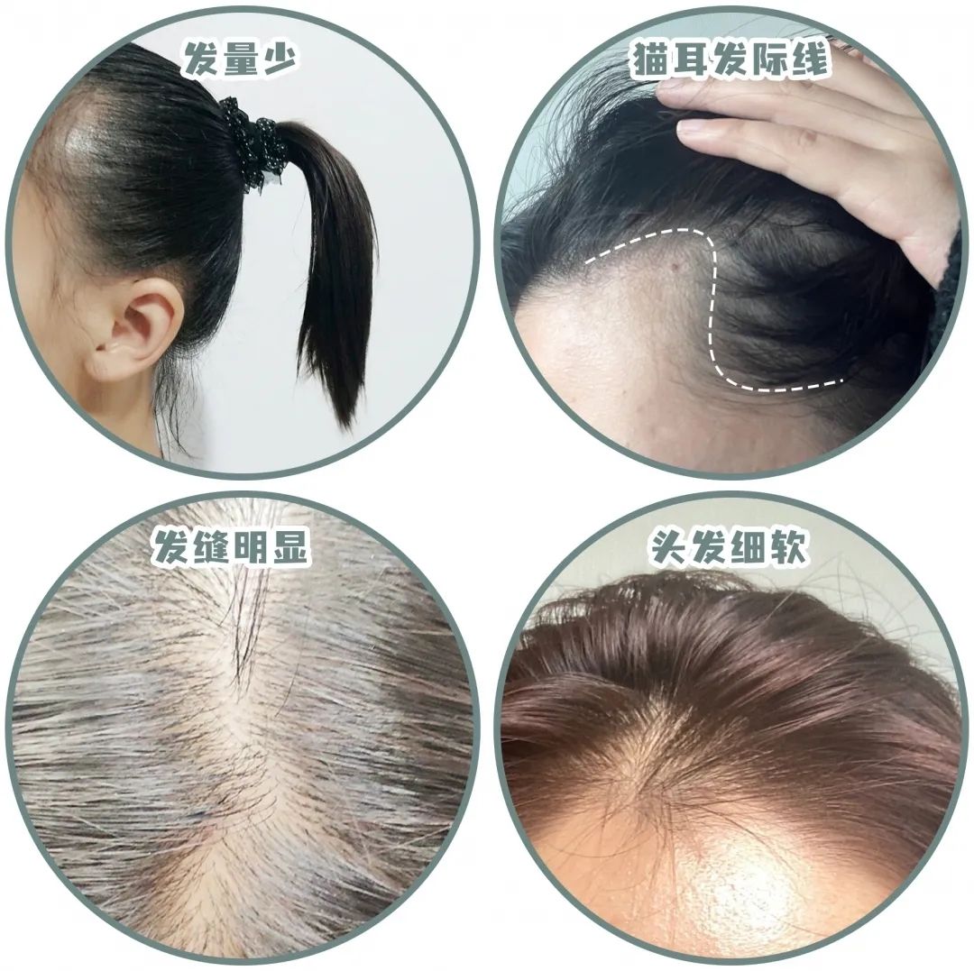 细软塌发量少蓬松,细软塌发量少发型测评