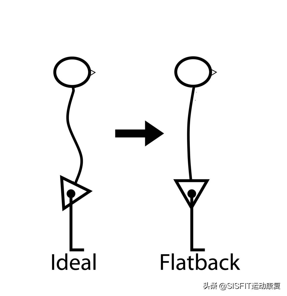 腰椎曲度变直的5个康复训练,腰椎曲度变直康复训练