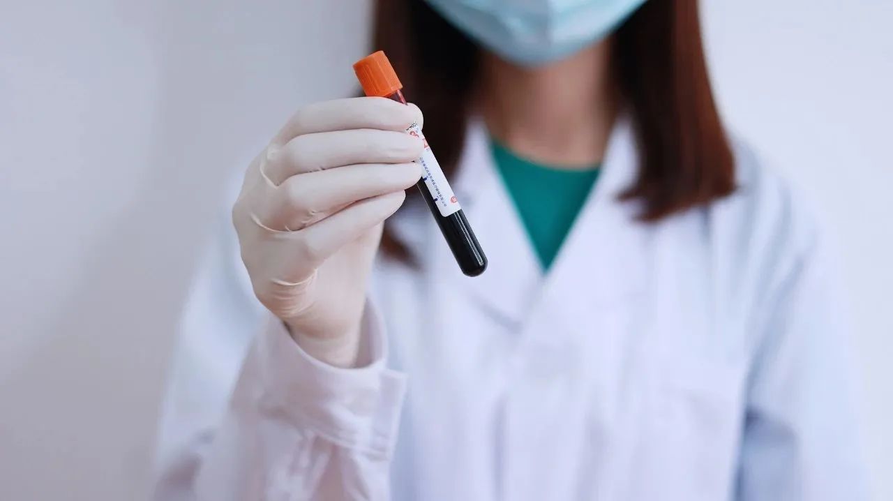 怎么判断过敏性紫癜的严重程度,过敏性紫癜怎么确诊要做哪些检查