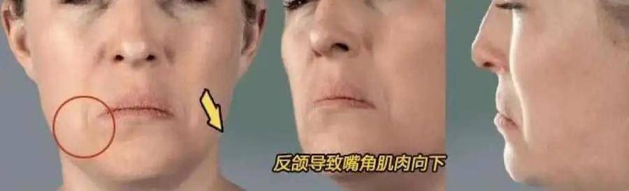 国民初恋毁容了,国民初恋盛世美颜