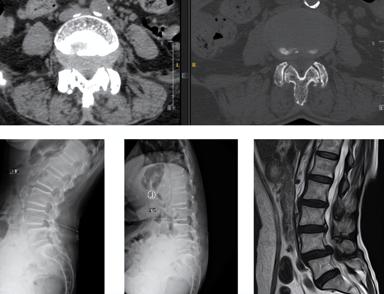 骨科看腰背痛做什么检查,腰背疼骨科检查没问题应该怎么办