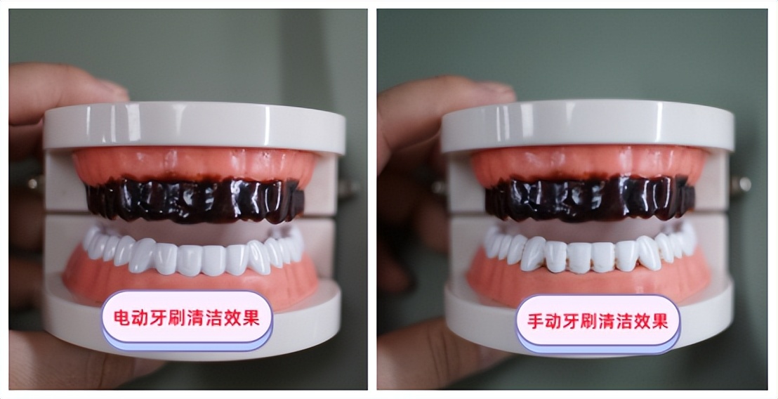 电动牙刷有给儿童买的必要吗,儿童电动牙刷的四大症结误区