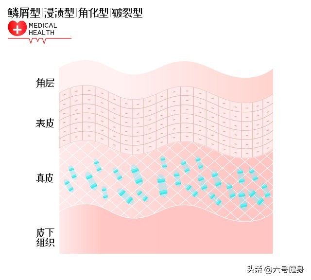 脸部肌肉松弛怎么锻炼视频,脸部松弛下垂的最好锻炼方法
