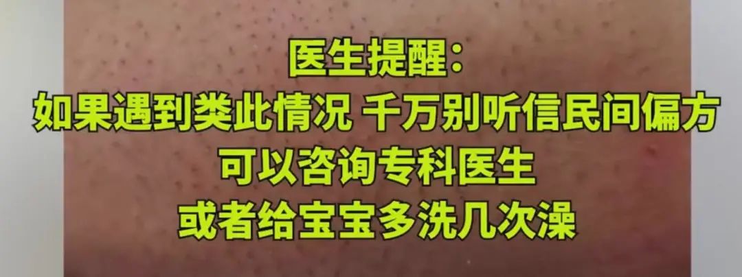 妈妈信偏方害弟弟,妈妈信偏方致宝宝生病