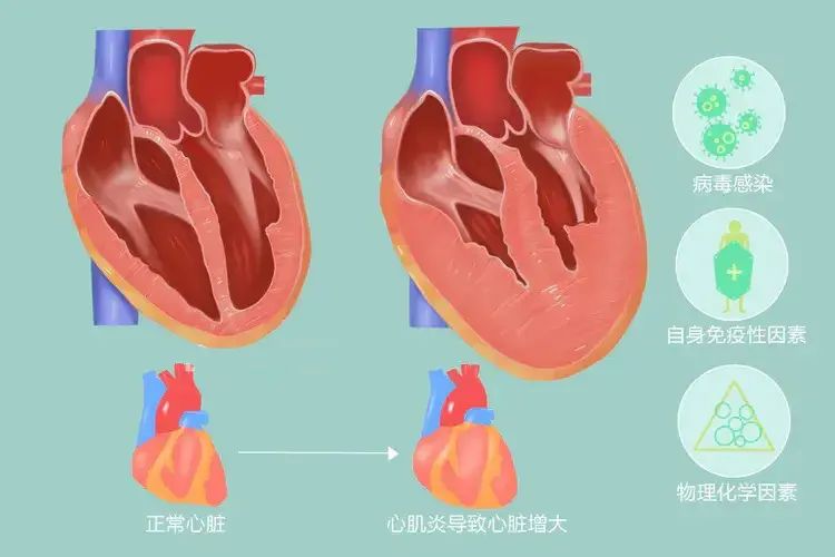 感冒千万不要乱吃药小心住icu,感冒进icu差点死亡