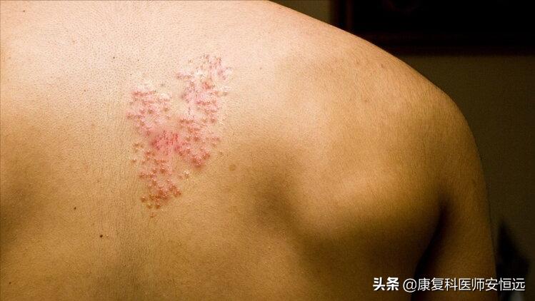 世上最疼的病是什么病？临床上这3种“疼痛”，经历过的都是超人