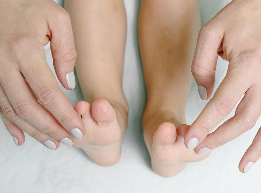 手把手教你如何治疗灰指甲,得了灰指甲去亮甲服务治疗行吗