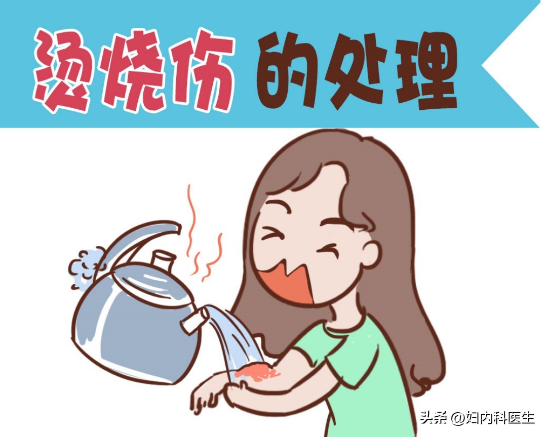 烧烫伤后该怎样处理？医生一文告诉您