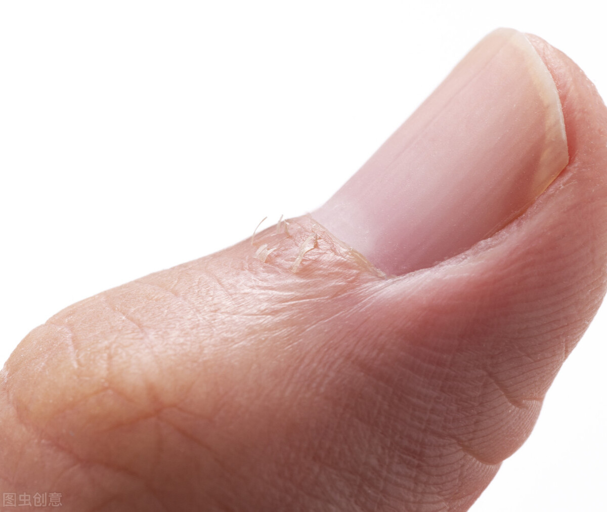 红霉素软膏涂眼部底下有什么效果,眼部周围很干可以用红霉素软膏