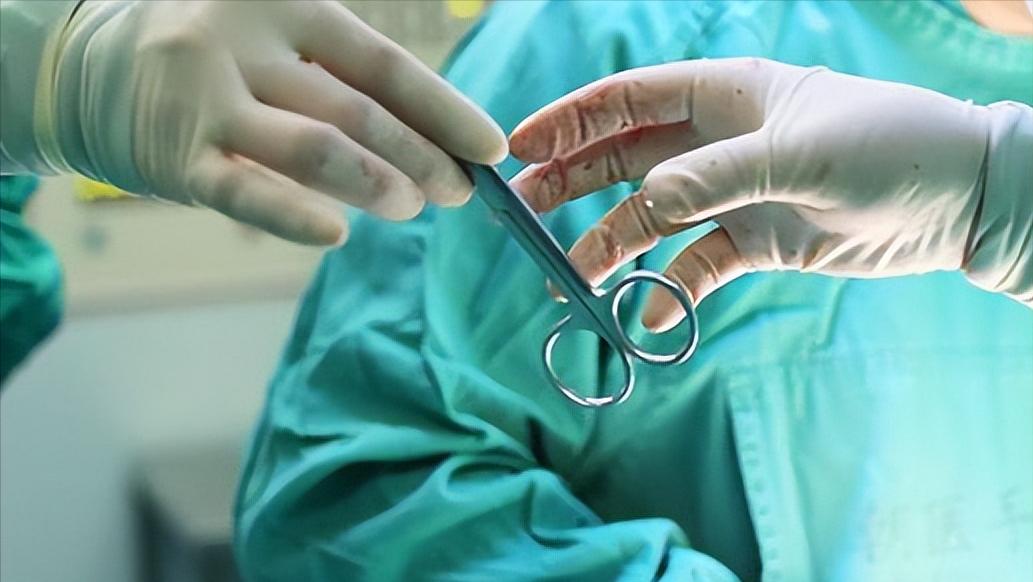 卵巢巧克力囊肿合并多囊卵巢,什么是巧克力卵巢囊肿怎么治疗