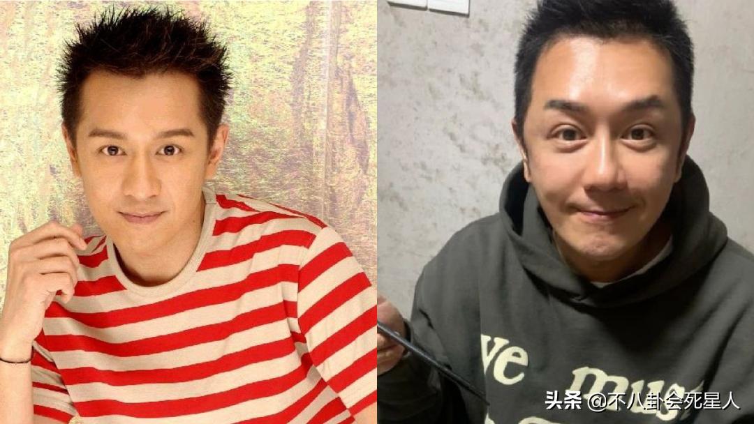 景甜悲伤蛙双眼皮照片,明星割双眼皮前后对比图