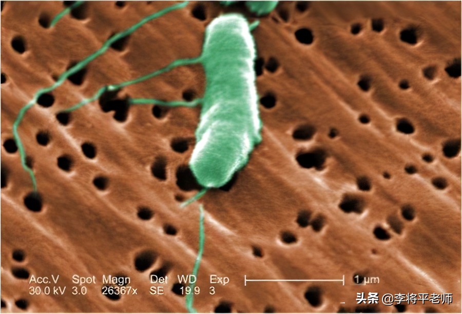 女子被河虾刺到导致截肢,被河虾扎手截肢