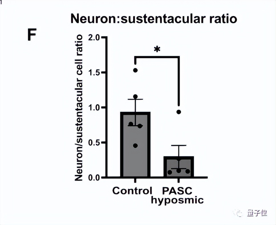 新冠后丧失嗅觉的关键原因找到了,新冠丧失嗅觉是怎么回事