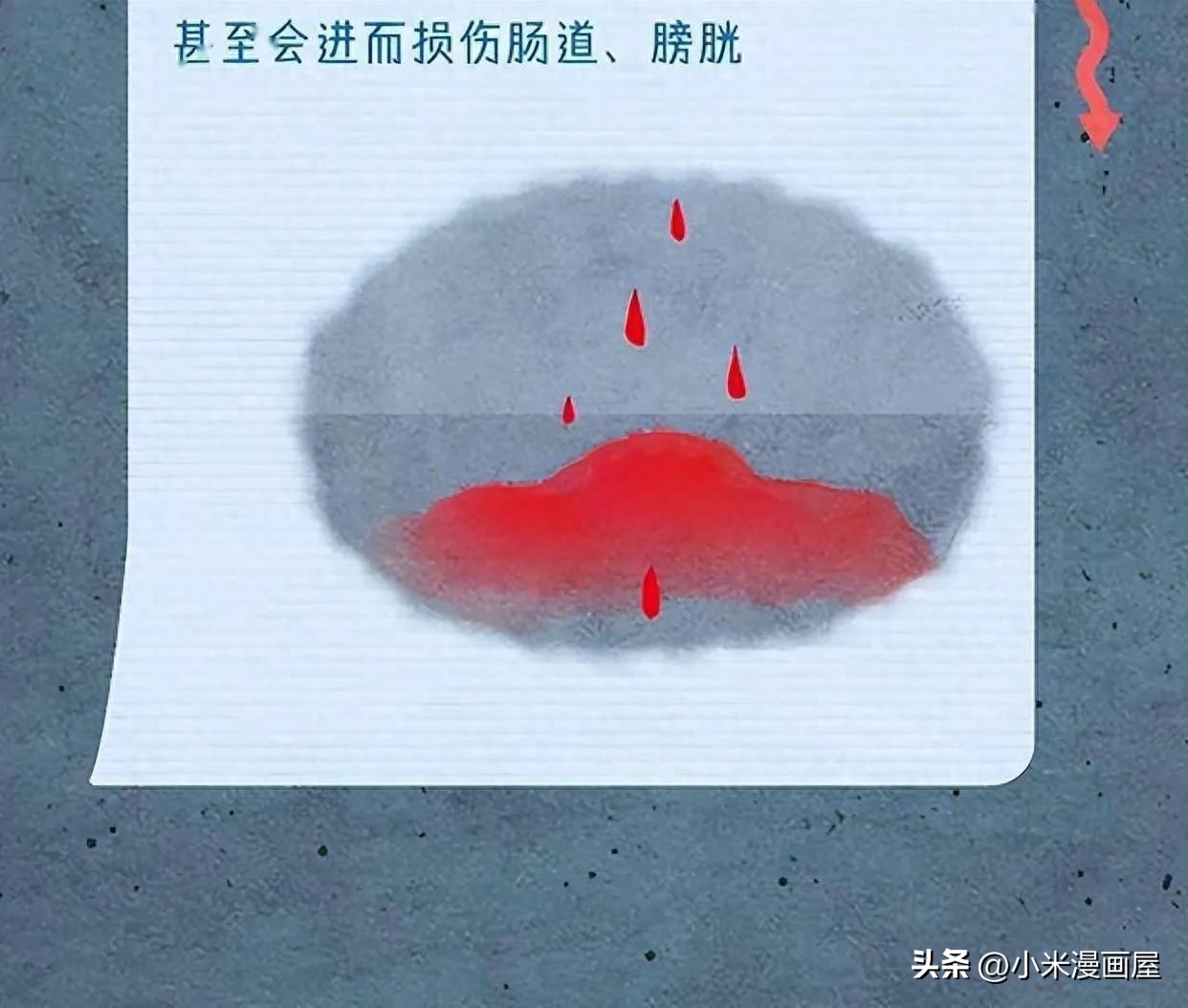 “擦边*行为性**”会不会怀孕？该如何正确避孕呢？漫画