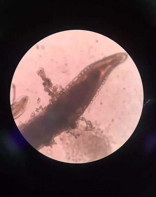 宝宝半夜屁股痒抓起大疙瘩,孩子屁股痒是因为虫吗