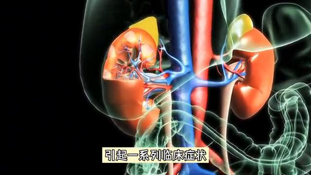 原发性醛固酮增多症发病机制图,原发性醛固酮增多症诊断和治疗