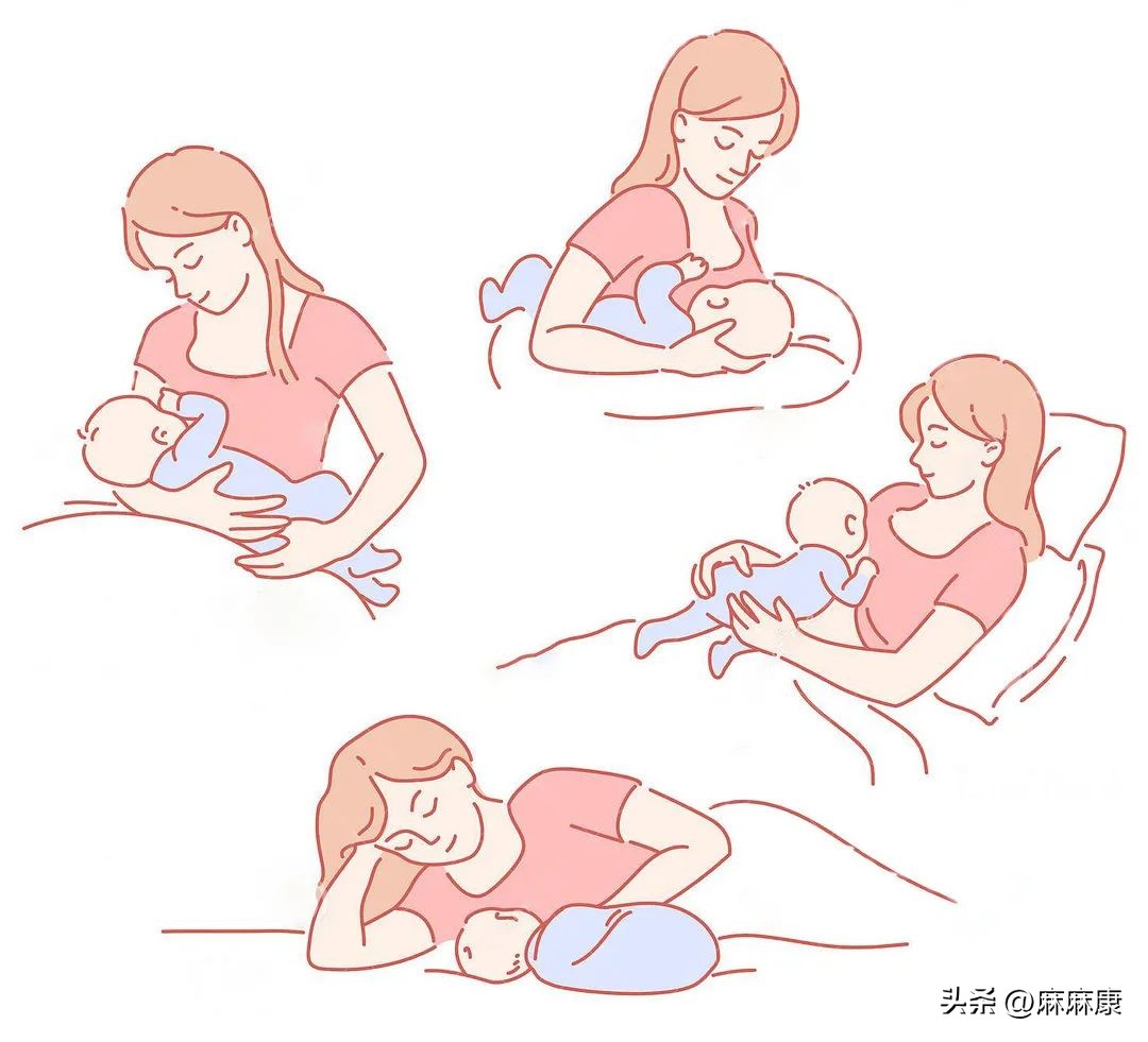 产后腰痛严重怎么办最快缓解,产后缓解腰痛最快方法